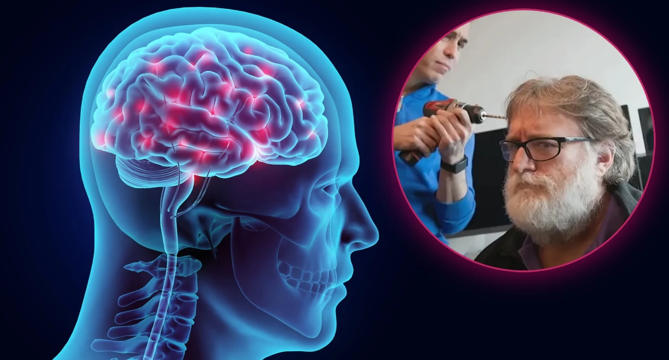 Chip mózgowy Starfish będzie lepszy niż Neuralink? Nadchodzi przełom Ilustracja anatomiczna ludzkiego mózgu przedstawiona w przekroju z podkreślonymi obszarami, w tle zbliżenie na mężczyznę z brodą i okularami, któremu druga osoba przykłada niewielkie narzędzie do głowy, prawdopodobnie w celach medycznych lub naukowych.