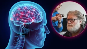 Neuralink ma rywala. Nowy chip mózgowy od szefa Valve w tym roku