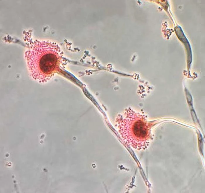 Grzyb Aspergillus fumigatus może zaatakować Europę.