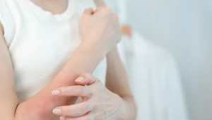 Ból głowy, suchość skóry i wypadanie włosów mogą być sygnałem nadmiaru witaminy A