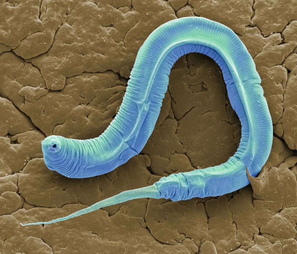 Badania z wykorzystaniem nicieni Caenorhabditis elegans zaowocowały trzema Nagrodami Nobla Badania z wykorzystaniem nicieni Caenorhabditis elegans zaowocowały trzema Nagrodami Nobla