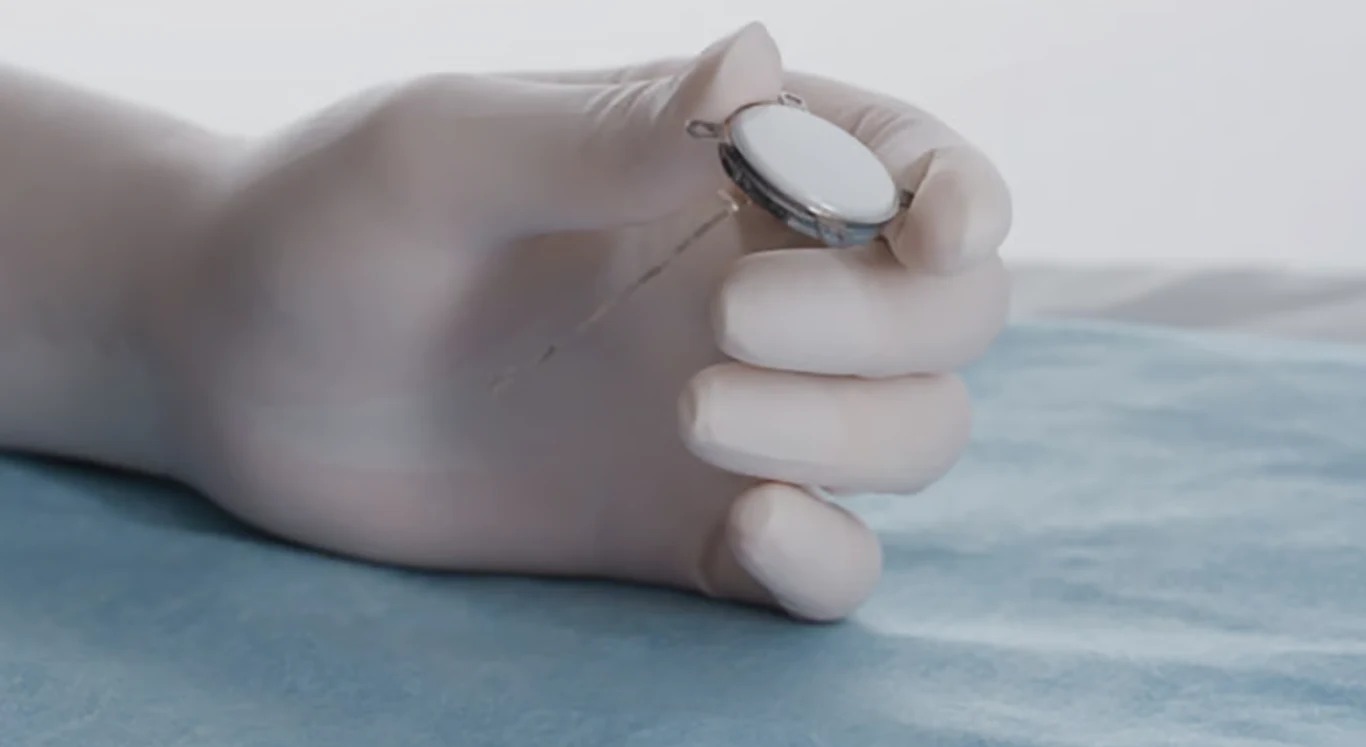 Chiny idą śladami USA. Pierwszy pacjent z implantem interfejsu mózg-komputer Ręka w rękawiczce chirurgicznej trzymająca implant medyczny z cienką nicią na tle niebieskiego materiału, co sugeruje przygotowanie do zabiegu medycznego.