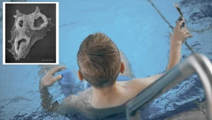 Dziecko zmarło przez amebę zjadającą mózg. Park wodny zamknięto