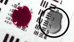 Przełom w chirurgii. Ta technologia pozwala "widzieć przez krew"
