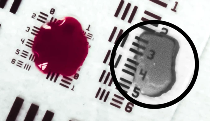 Technologia ma zapewnić chirurgom widok tkanek i struktur zasłoniętych przez nagromadzoną krew
