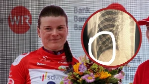 Marta Lach i zdjęcie RTG złamanego żebra