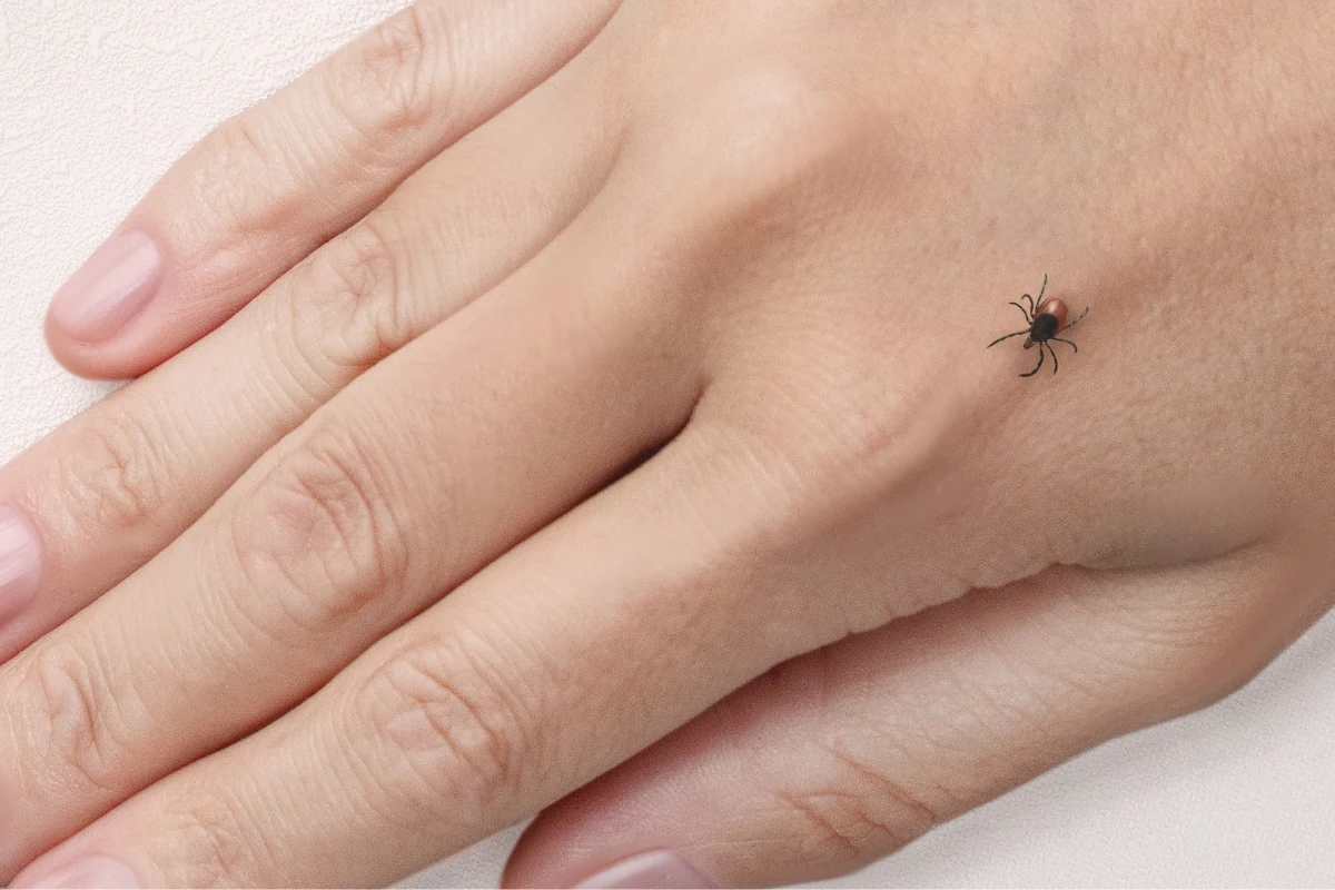 W przypadku boreliozy nie zaleca się antybiotykoterapii trwającej dłużej niż 28 dni