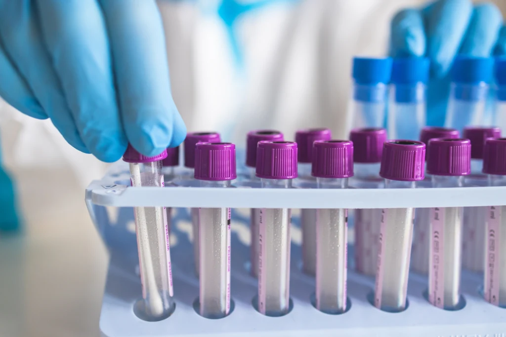 Morfologię warto wykonywać co najmniej raz w roku