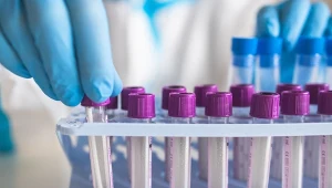 Jedno proste badanie może uratować ci życie. Rób chociaż raz w roku