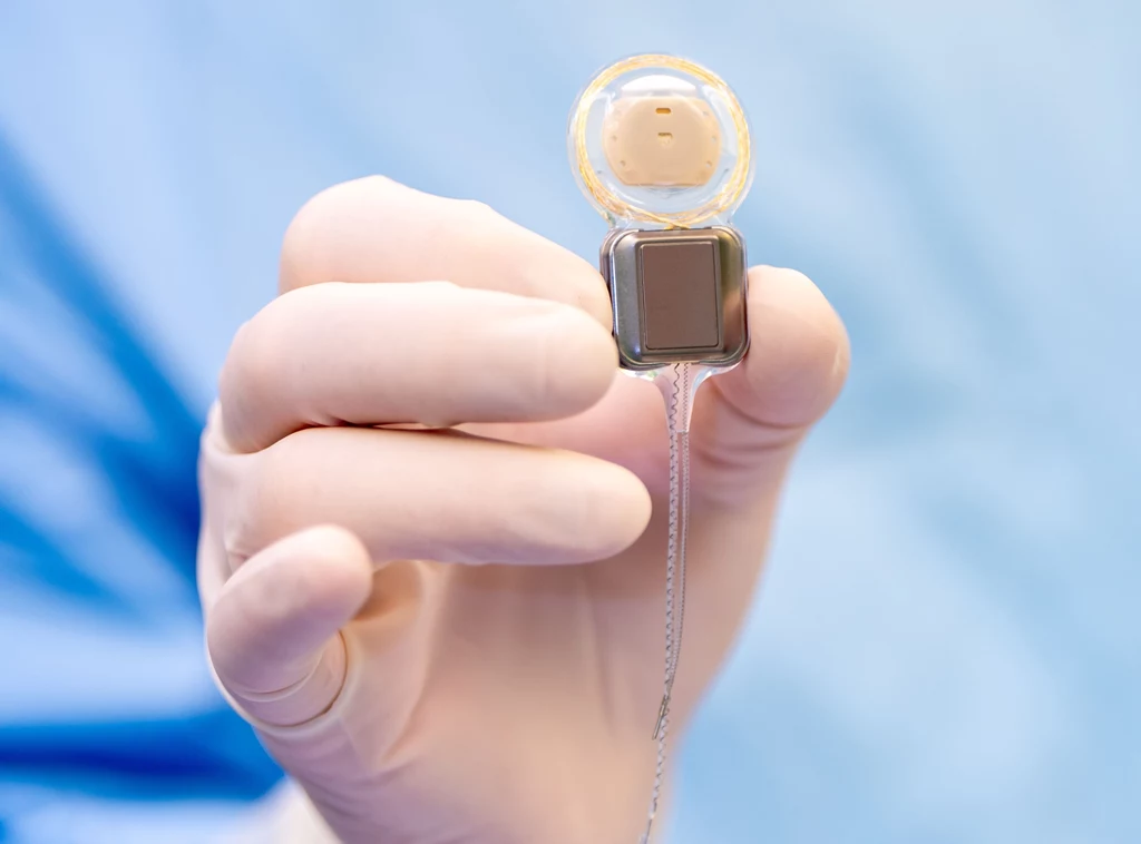 74-letniej pacjentce został wszczepiony malutki implant ślimakowy. 74-letniej pacjentce został wszczepiony malutki implant ślimakowy.