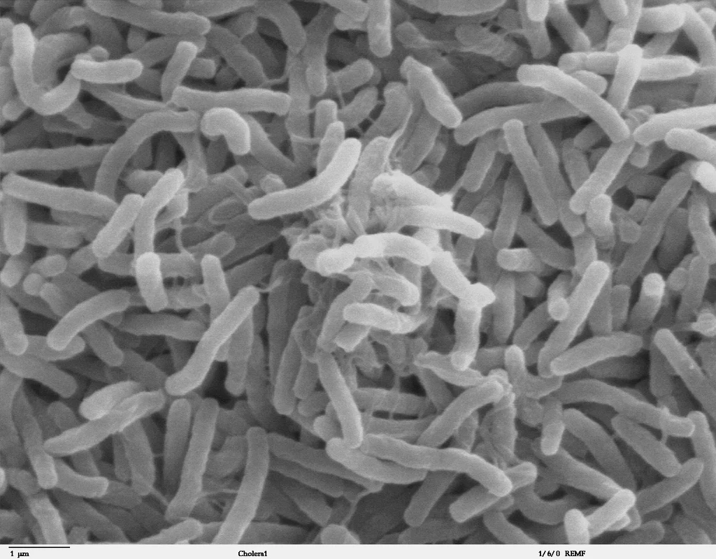 Obraz bakterii Vibrio cholerae z mikroskopu elektronowego Duża liczba pałeczek bakteryjnych o podłużnym kształcie, zgrupowanych blisko siebie, widocznych w powiększeniu mikroskopowym.