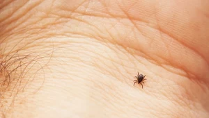 Masło do usuwania kleszcza? GIS alarmuje: to bardzo niebezpieczne 