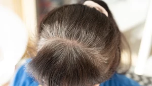 Masz cienkie i rzadkie włosy? Oto fryzury, które dodadzą im objętości 