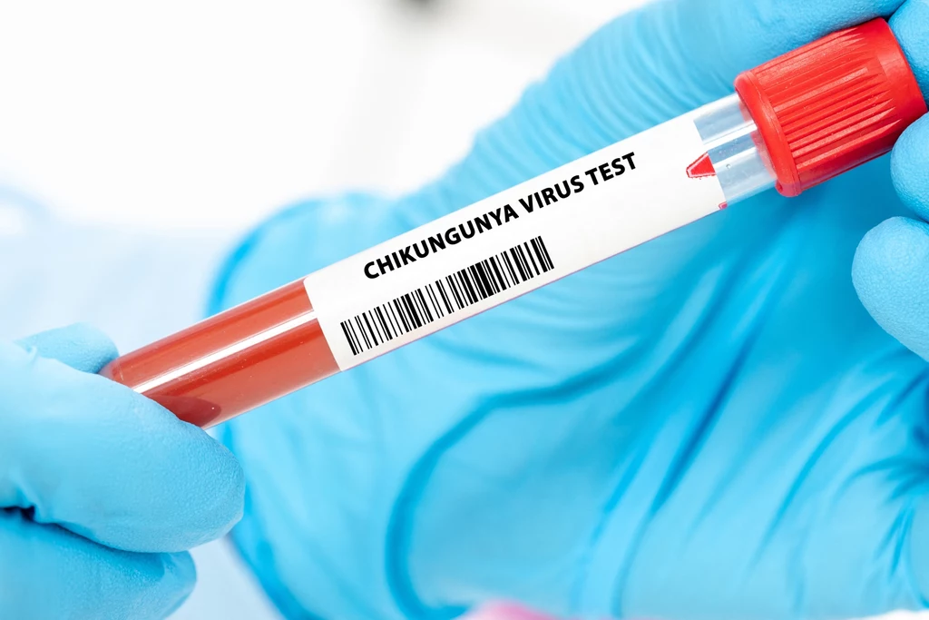 Rurka z krwią oznaczona napisem 'Chikungunya Virus Test' trzymana w rękawiczkach laboratoryjnych, na białym tle.