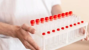 Tak rozpoznasz stan zapalny w organizmie. Przydatne są trzy badania