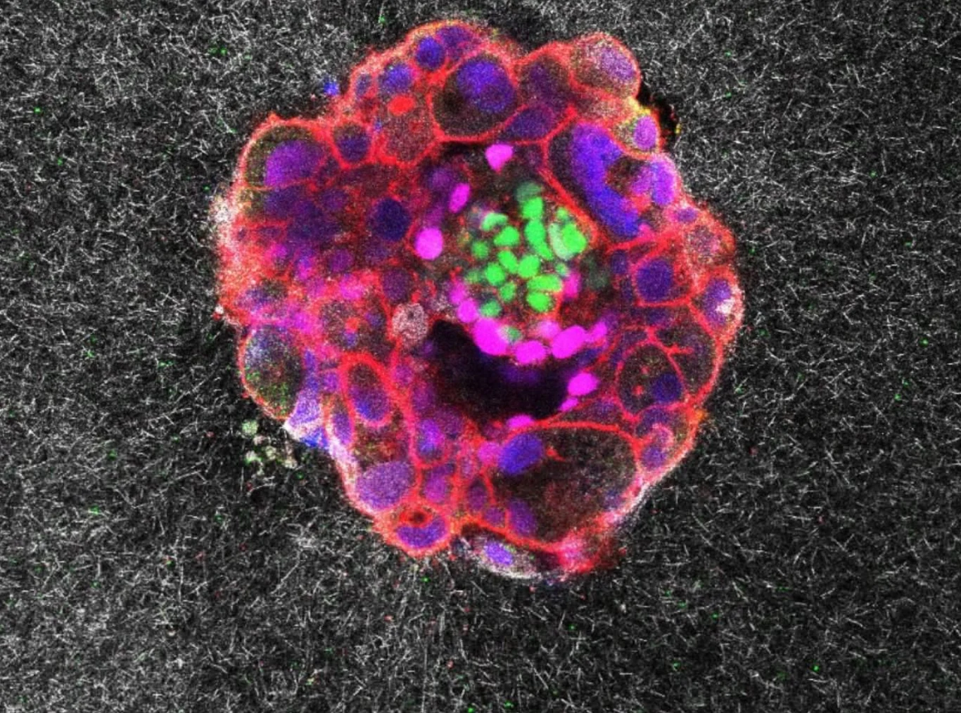 Wgląd w implantację ludzkiego zarodka może pomóc w leczeniu niepłodności Kolorowa mikroskopowa struktura z wyraźnymi komórkami, których krawędzie są oznaczone na czerwono, a wnętrze zawiera skupiska zielonych i fioletowych punktów, otoczona szarym tłem, sugerująca hodowlę komórek lub model organoidu.