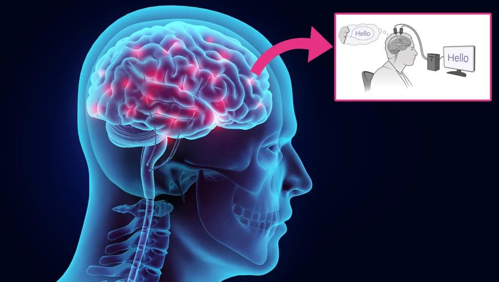 Implant mózgowy może czytać w myślach? Urządzenie zamienia myśli w mowę z wysoką skutecznością Implant mózgowy może czytać w myślach? Urządzenie zamienia myśli w mowę z wysoką skutecznością