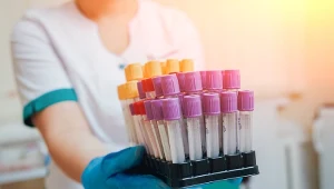 Badanie na onkopierwiastki coraz popularniejsze. Czy pomoże wyprzedzić raka?