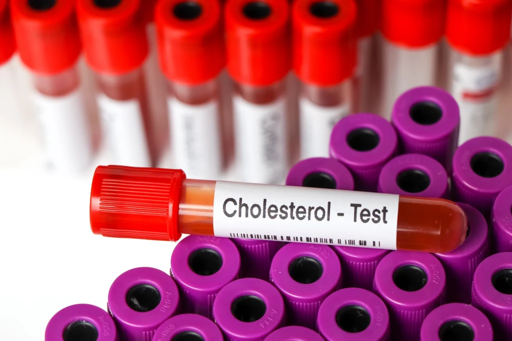 Jak często badać poziom cholesterolu? Częściej niż mogłoby się wydawać Jak często badać poziom cholesterolu? Częściej niż mogłoby się wydawać