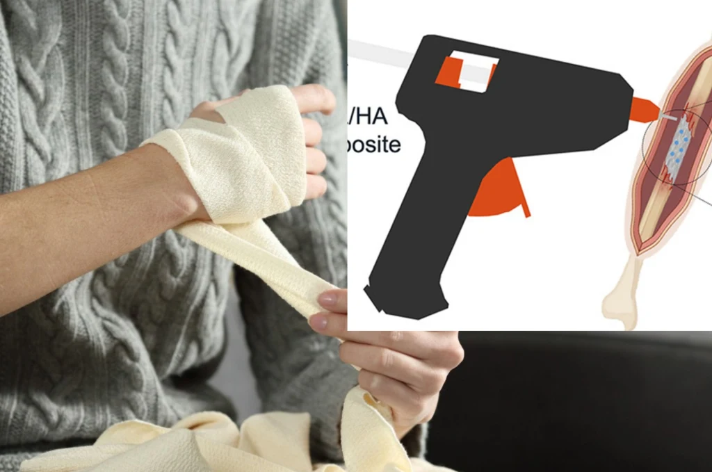 Wygląda jak pistolet do kleju na gorąco. Wypełnia ubytki kostne Osoba bandażująca swoje nadgarstki lub dłoń na tle grafiki przedstawiającej pistolet do kleju oraz schemat medyczny, który zawiera opis zastosowania materiału kompozytowego wewnątrz struktury przypominającej mięsień.