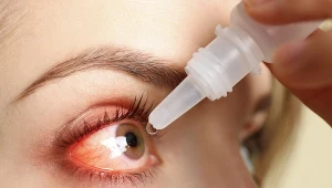 Krople do oczu