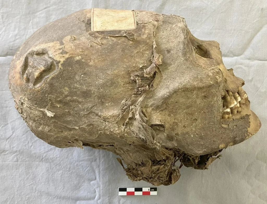 Zmumifikowana głowa ludzka z widocznymi zębami, zachowaną skórą na czaszce oraz fragmentami tkanek miękkich, spoczywająca na jasnej powierzchni laboratoryjnej obok miarki.