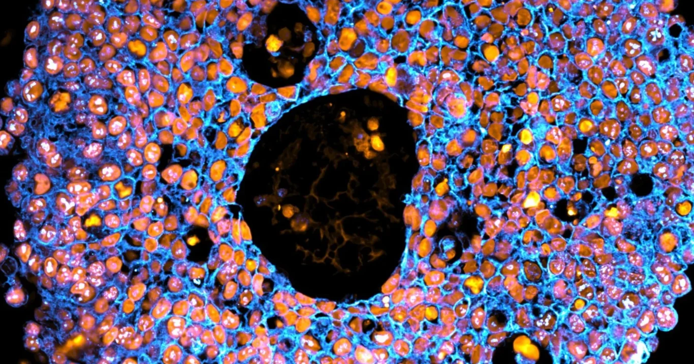Obraz mikroskopowy organoidu łożyska. Obraz wykonany w UTS Microbial Imaging Facility przez dr Claire Richards Różnokolorowe komórki widoczne pod mikroskopem, otaczające centralną czarną przestrzeń, z wyraźnie zaznaczonymi błękitnymi i pomarańczowymi strukturami.