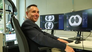 AI niczego nie przeoczy. Zobaczy to, czego nie zauważył lekarz