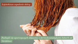 Pielęgnacja włosów przy łojotokowym zapaleniu skóry