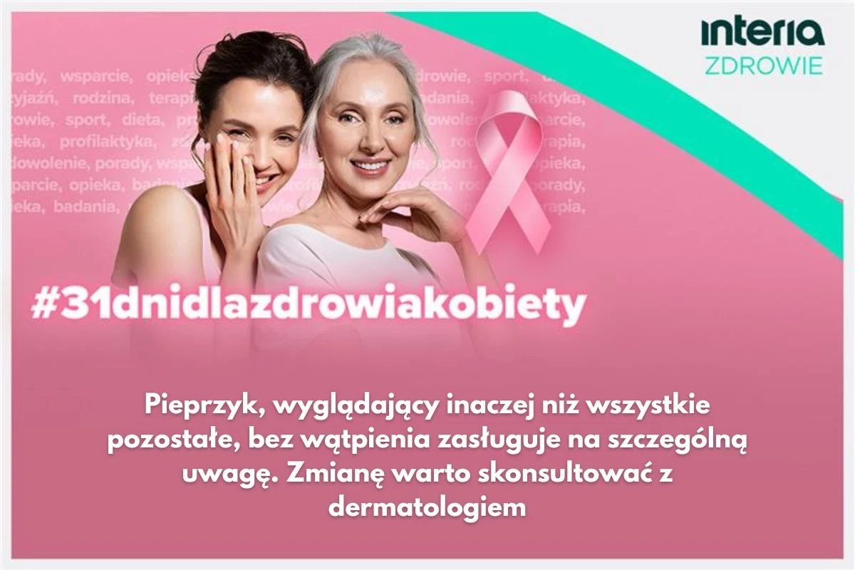 Każdy nietypowy pieprzyk powinien być skonsultowany z dermatologiem Każdy nietypowy pieprzyk powinien być skonsultowany z dermatologiem