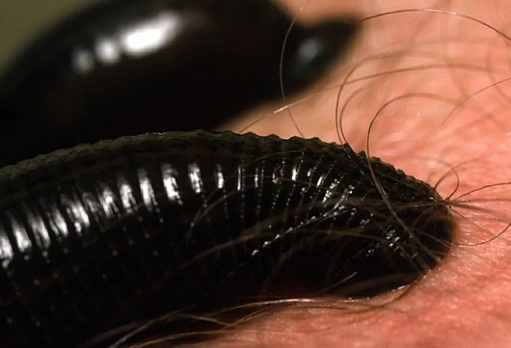 Pijawki to dzisiaj wyspecjalizowani krwiopijcy Czarny pijawka przyczepiona do owłosionej, ludzkiej skóry, wyraźnie widoczne segmenty ciała i pojedyncze włosy na skórze.