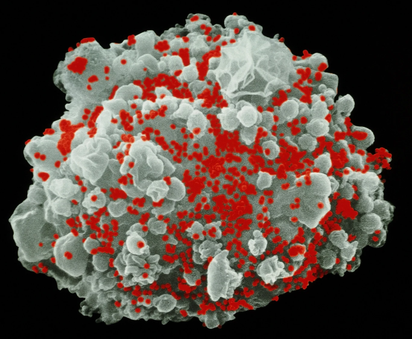 Komórka T zakażona wirusem HIV. Struktura komórki z licznymi czerwonymi punktami widocznymi na powierzchni, co może wskazywać na obecność wirusów lub nanocząstek, całość sfotografowana w dużym powiększeniu na tle czerni.