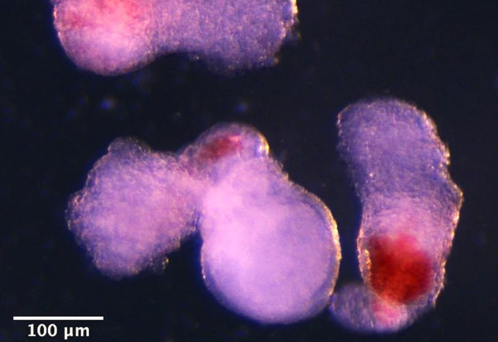 Hematoidy odzwierciedlają drugą falę rozwoju komórek krwi, z której mogą powstawać wyspecjalizowane komórki układu odpornościowego, na przykład limfocyty T Hematoidy odzwierciedlają drugą falę rozwoju komórek krwi, z której mogą powstawać wyspecjalizowane komórki układu odpornościowego, na przykład limfocyty T
