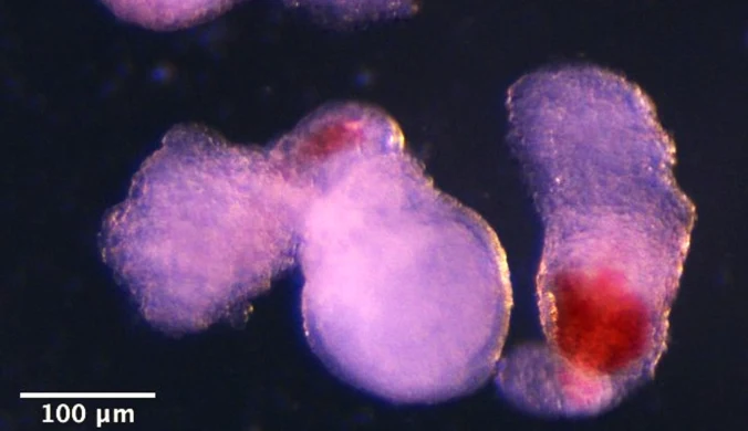 Hematoidy odzwierciedlają drugą falę rozwoju komórek krwi, z której mogą powstawać wyspecjalizowane komórki układu odpornościowego, na przykład limfocyty T