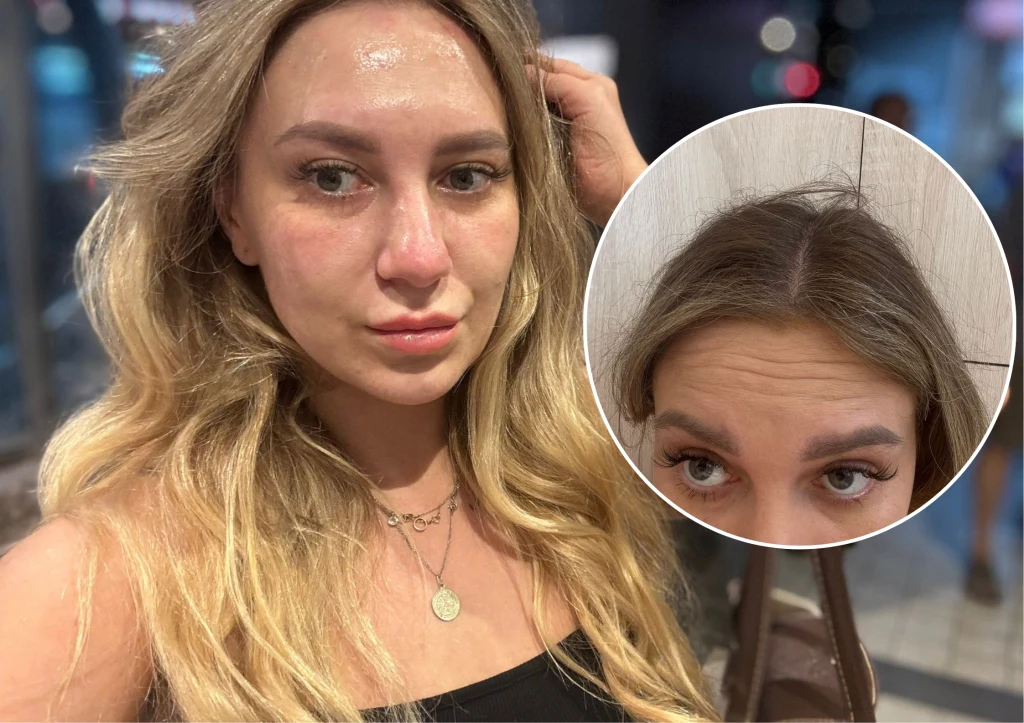 Kobieta z długimi blond włosami o lekko spoconej twarzy, ubrana w czarny top i złoty naszyjnik, patrzy poważnie w stronę aparatu, a wstawka pokazuje zbliżenie na jej skórę głowy z widocznym odrostem włosów.