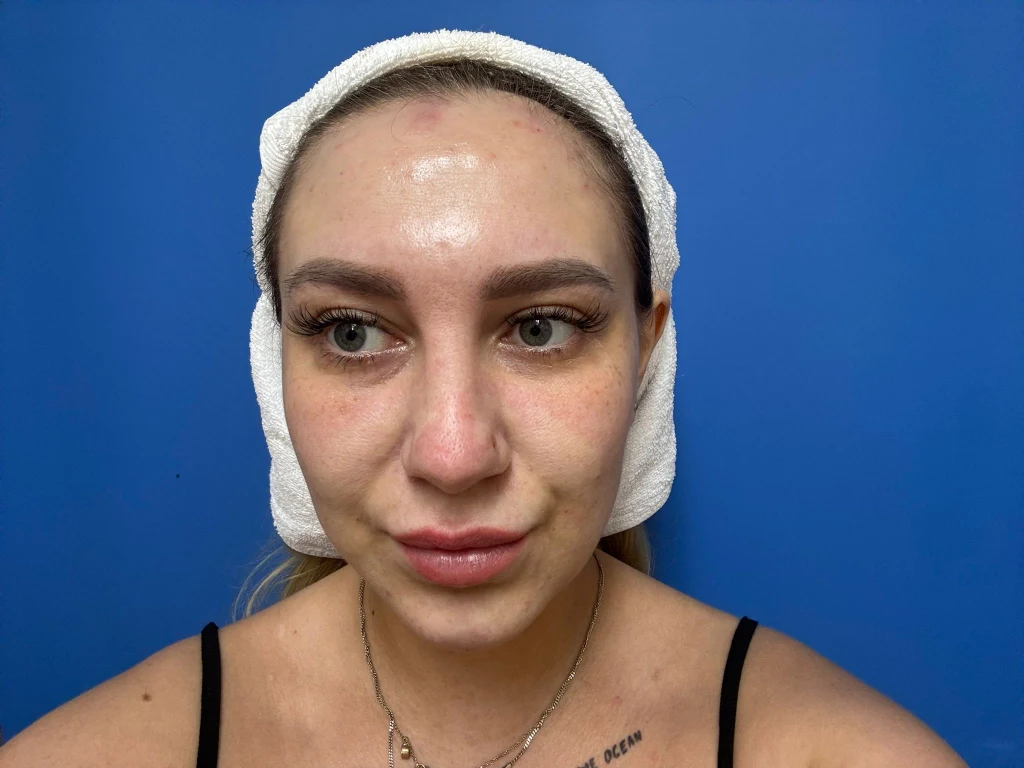 Kobieta w białej opasce na głowie z gładką cerą, lekkim makijażem oraz widoczną zmianą skórną na czole na tle niebieskiej ściany.
