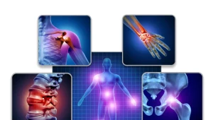 Choroba zwyrodnieniowa stawów (ChZS)