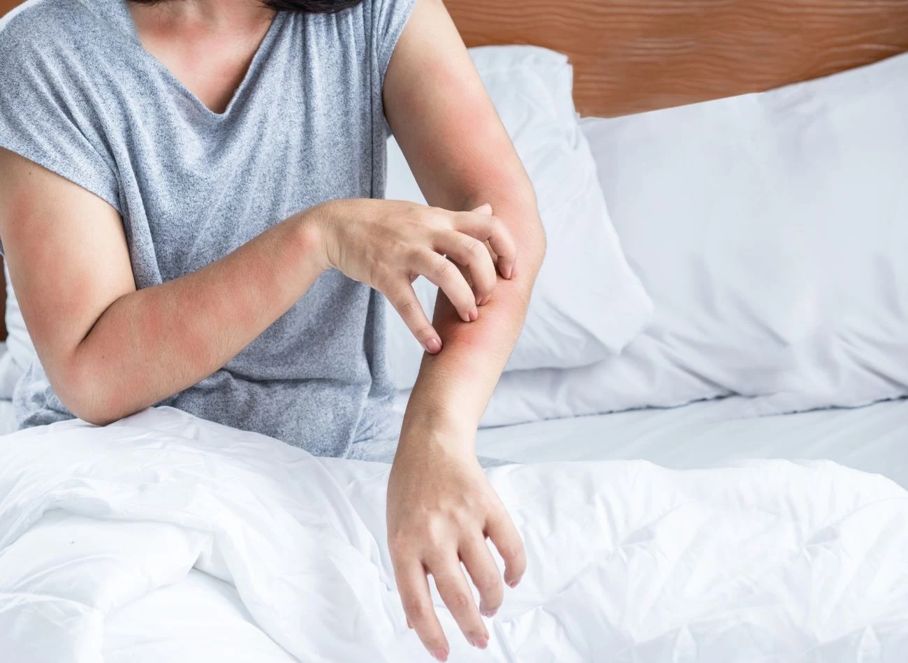 Pluskwy do mieszkania można "przynieść" z wakacji czy podróży służbowej, Często są obecne w pokojach hotelowych.