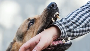 Spotkanie z agresywnym psem może zakończyć się tragicznie.