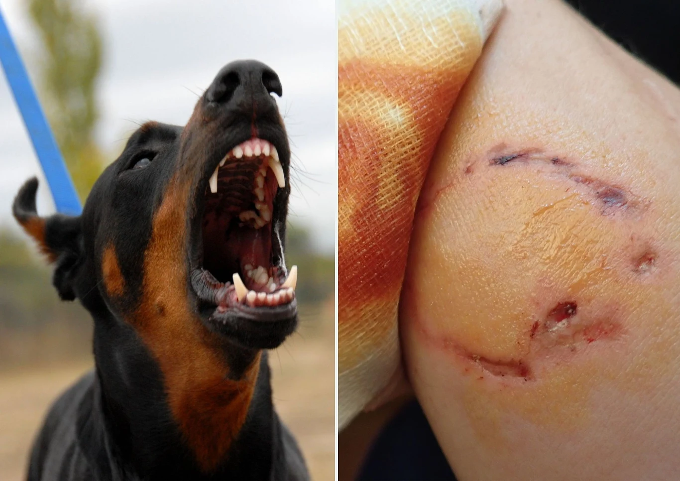 Nawet powierzchowne ugryzienie przez psa, a tym bardziej groźniejsze rany wymagają interwencji