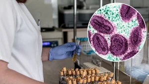 Nowe przypadki zakażeń w kilku krajach Europy. WHO ostrzega przed wirusem