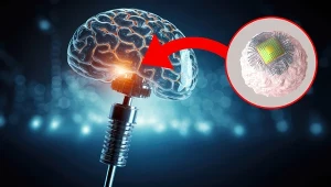 Mikroimplant zamiast operacji mózgu. Podają go dożylnie