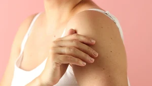 Nie każda kropka to pieprzyk. Rubinki mogą zdradzić, że rozwija się choroba