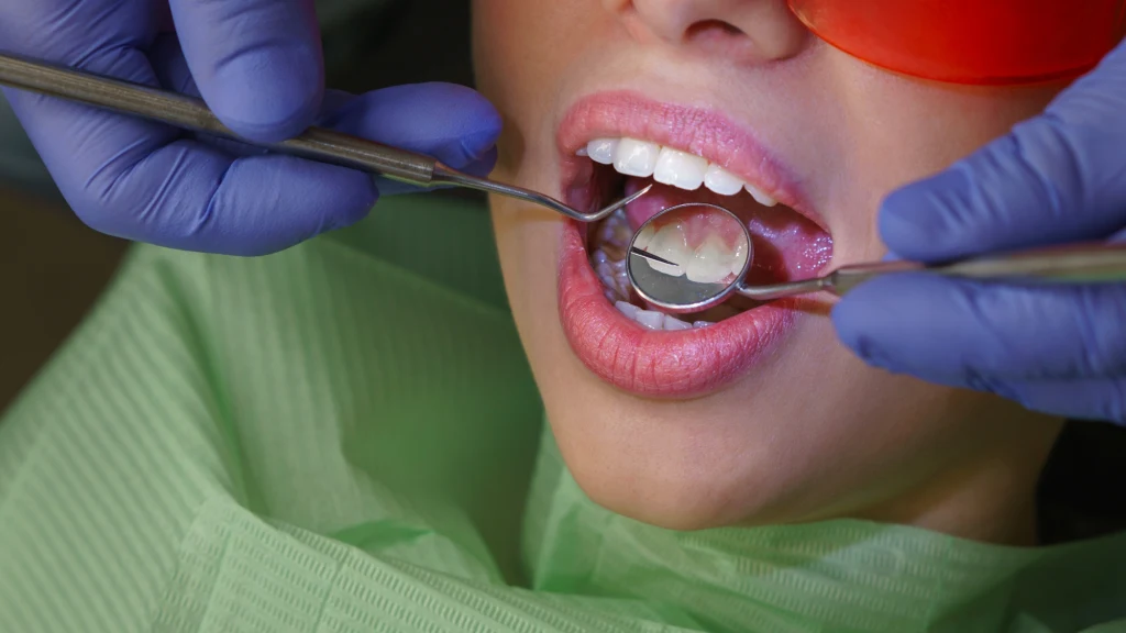 Rtęć z plomb dentystycznych przedostaje się do środowiska Dentysta w rękawiczkach ochronnych sprawdza stan zębów pacjenta przy użyciu lusterka i narzędzia dentystycznego, pacjentka nosi okulary ochronne, a jej usta są szeroko otwarte.