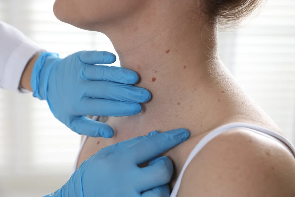 Lekarz w niebieskich rękawiczkach ochronnych dotyka okolic szyi pacjentki w celu przeprowadzenia badania palpacyjnego węzłów chłonnych lub tarczycy.