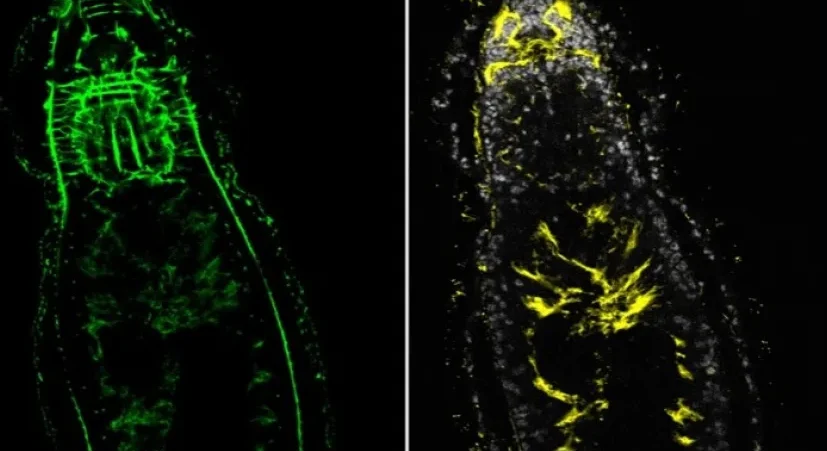 Obraz mikroskopowy dwóch organizmów lub fragmentów ciała, po lewej stronie z zielonym fluorescencyjnym zabarwieniem, po prawej stronie z żółtym podświetleniem. Struktury mają podłużny kształt, widoczne są wnętrza i kontury oraz wyraźnie zaznaczone deta...