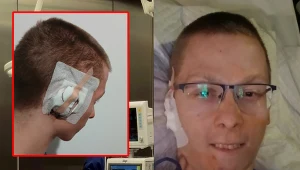 Lekarze z Warszawy stworzyli mu nowe ucho. Niezwykła historia Kamila