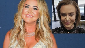 Agnieszka Kotońska zdjęła doczepy. Widok wprawił ludzi w osłupienie