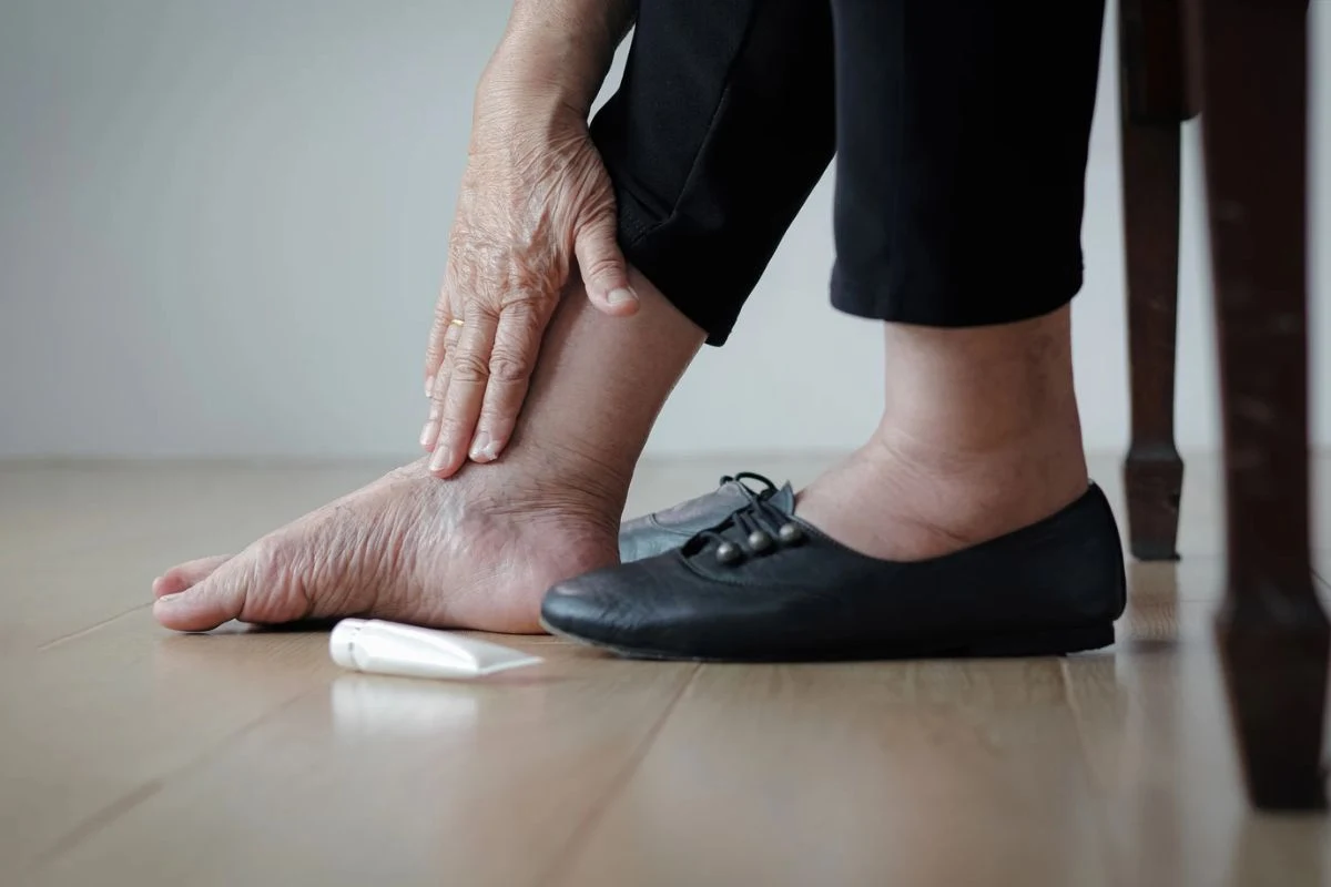 Obrzęki "ciastowate" to takie, kiedy po naciśnięciu skóry pozostają ślady przypominające wgłębienie w wyrabianym cieście