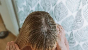 Skóra głowy po 40. roku życia. Jak o nią dbać, by włosy rosły gęstsze